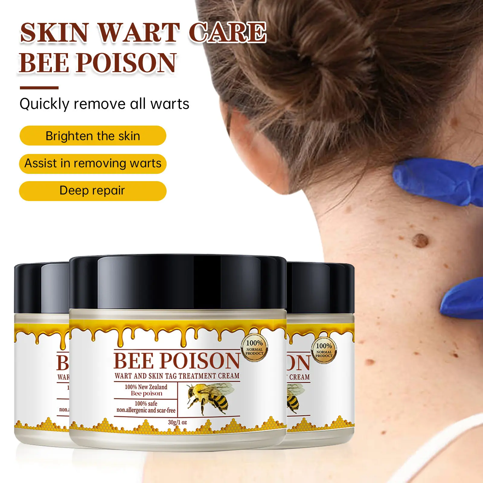 Bee poison Wart and Mole Removal Treatment Cream - Image 2