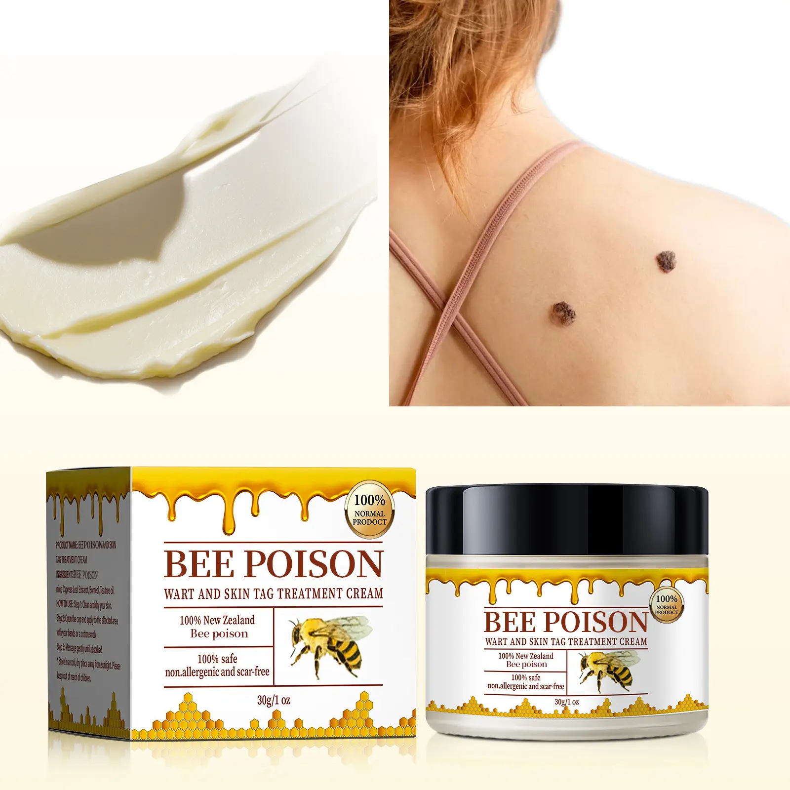 Bee poison Wart and Mole Removal Treatment Cream - Image 3