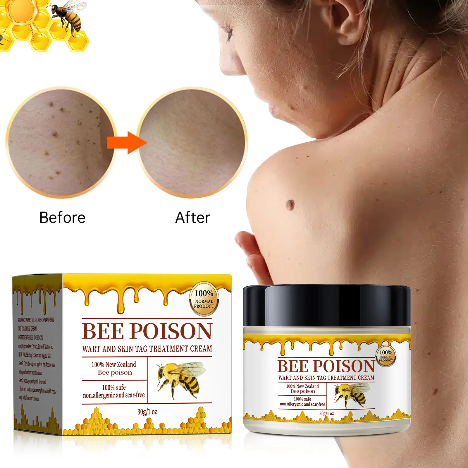 Bee poison Wart and Mole Removal Treatment Cream - Image 4