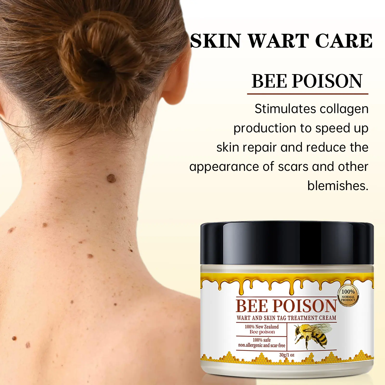 Bee poison Wart and Mole Removal Treatment Cream - Image 5