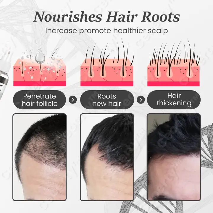 SheddStop Pro-Strength Hair Spray - Image 3