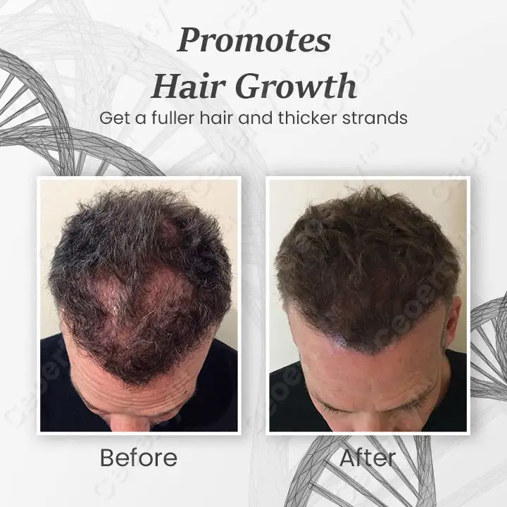 SheddStop Pro-Strength Hair Spray - Image 4