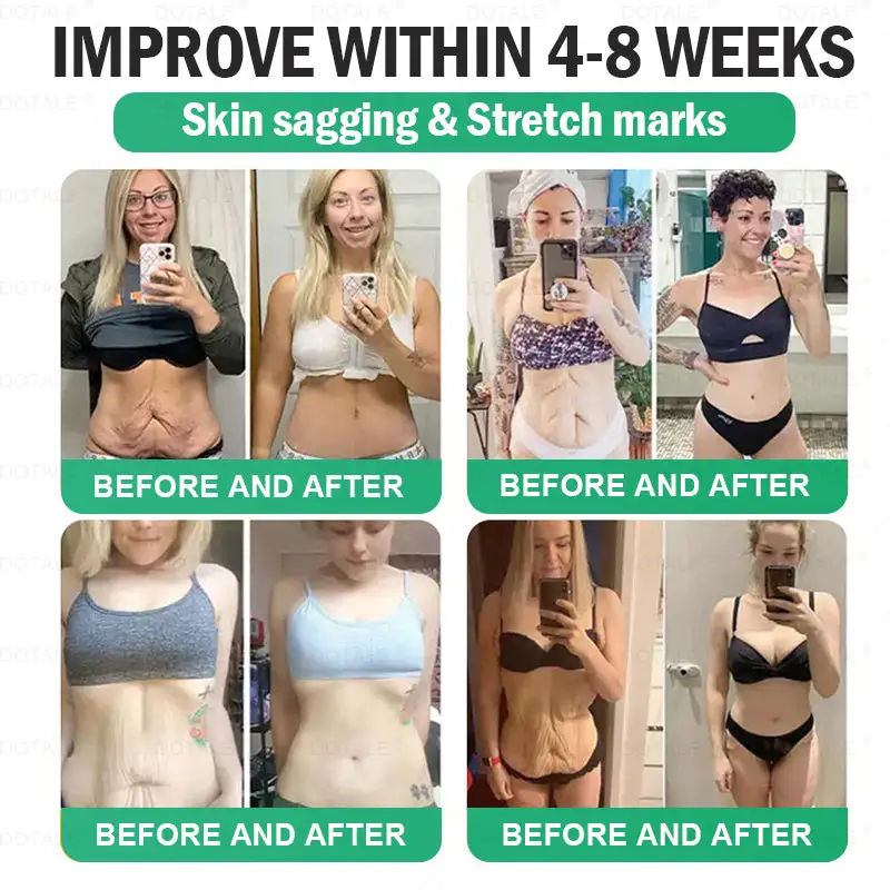 𝑵𝑨𝑫+ 𝑴𝒐𝒓𝒊𝒏𝒈𝒂 𝑩𝒆𝒓𝒃𝒆𝒓𝒊𝒏𝒆 𝑨𝑴𝑷𝑲 𝑺𝒖𝒑𝒑𝒐𝒓𝒕 𝑵𝒂𝒏𝒐 𝑴𝒊𝒄𝒓𝒐𝒏𝒆𝒆𝒅𝒍𝒆 𝑷𝒂𝒕𝒄𝒉 - Image 6