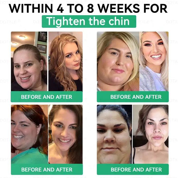 𝑵𝑨𝑫+ 𝑴𝒐𝒓𝒊𝒏𝒈𝒂 𝑩𝒆𝒓𝒃𝒆𝒓𝒊𝒏𝒆 𝑨𝑴𝑷𝑲 𝑺𝒖𝒑𝒑𝒐𝒓𝒕 𝑵𝒂𝒏𝒐 𝑴𝒊𝒄𝒓𝒐𝒏𝒆𝒆𝒅𝒍𝒆 𝑷𝒂𝒕𝒄𝒉 - Image 7