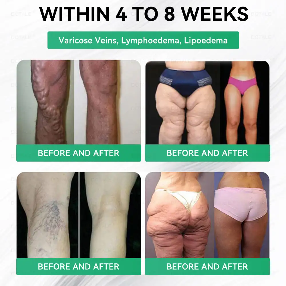 𝑵𝑨𝑫+ 𝑴𝒐𝒓𝒊𝒏𝒈𝒂 𝑩𝒆𝒓𝒃𝒆𝒓𝒊𝒏𝒆 𝑨𝑴𝑷𝑲 𝑺𝒖𝒑𝒑𝒐𝒓𝒕 𝑵𝒂𝒏𝒐 𝑴𝒊𝒄𝒓𝒐𝒏𝒆𝒆𝒅𝒍𝒆 𝑷𝒂𝒕𝒄𝒉 - Image 8