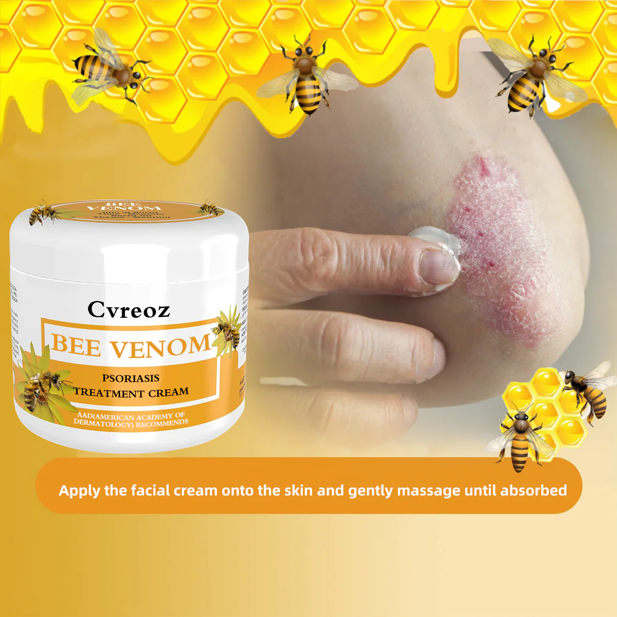 Cvreoz Bee Venom Psoriasis Treatment Cream - Image 5