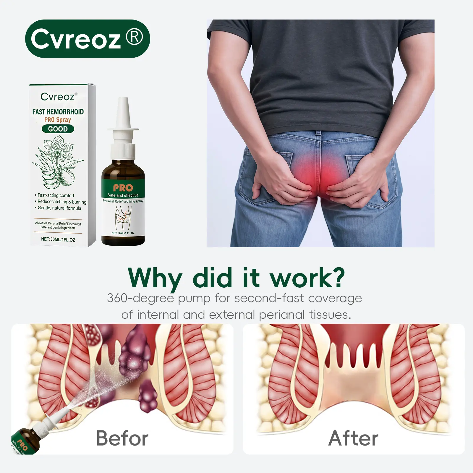 🎅 𝘾𝙝𝙧𝙞𝙨𝙩𝙢𝙖𝙨 𝙎𝙖𝙡𝙚 | Fast Hemorrhoid PRO Spray - Image 4