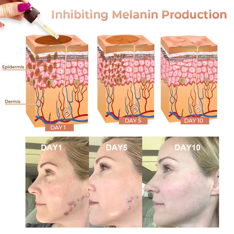 Melanin Correcting Facial Serum - Image 10