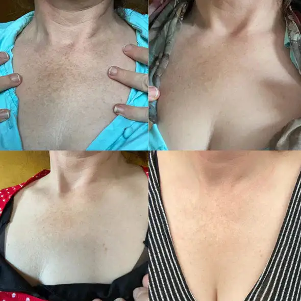 Melanin Correcting Facial Serum - Image 8