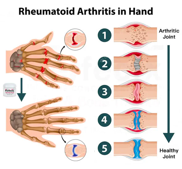Flashing New Zealand Bee Venom Professional Treatment Gel - Image 4
