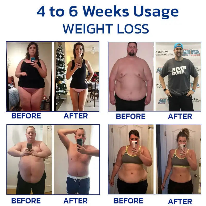 Slenderfast Lymphatic Graphene Bracelet - Image 2