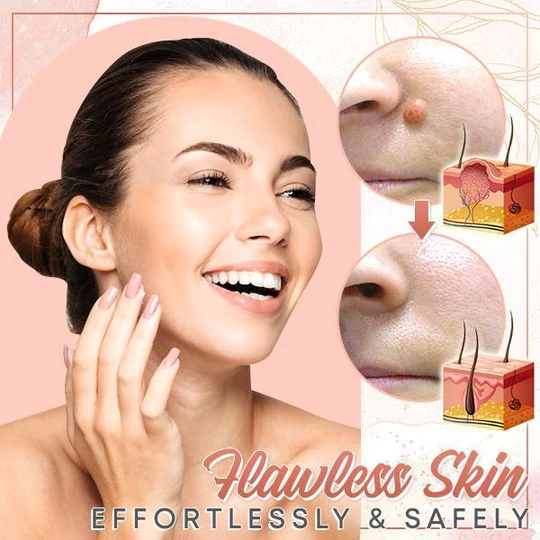 Herbal Wart Skin Removal Ointment - Image 3