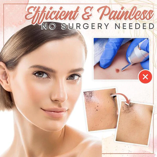 Herbal Wart Skin Removal Ointment - Image 6