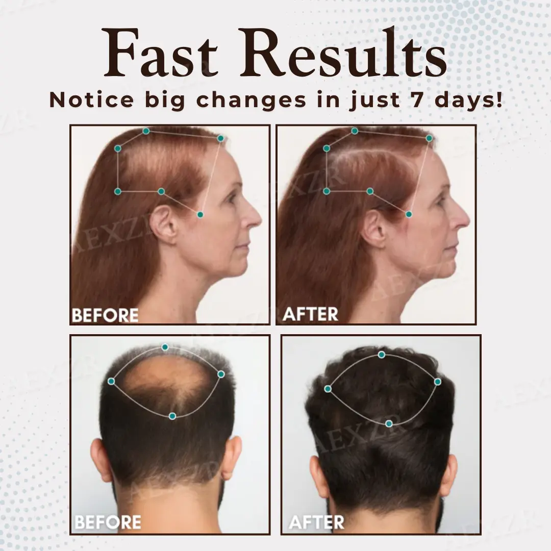 Hair Regrowth Capsules - Image 2