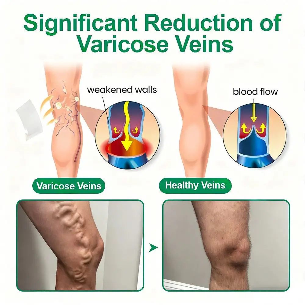 VeinTarget Microneedle Patch - Image 4