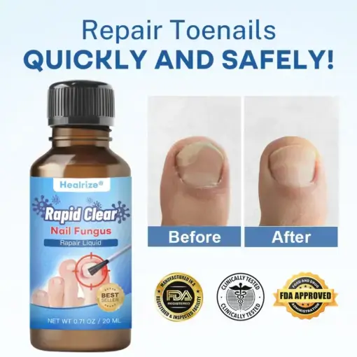 Nano Rapid Clear Nail Fungus Rapair Liquid Effective in Seven Days, Permanently Eliminates the Root