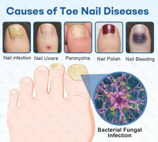 Nano Rapid Clear Nail Fungus Rapair Liquid Effective in Seven Days, Permanently Eliminates the Root - Image 5