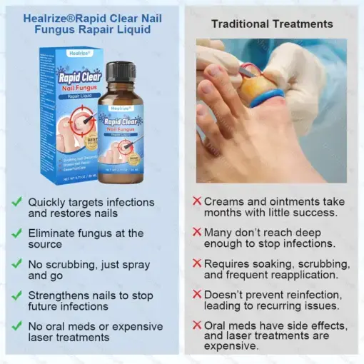 Nano Rapid Clear Nail Fungus Rapair Liquid Effective in Seven Days, Permanently Eliminates the Root - Image 6