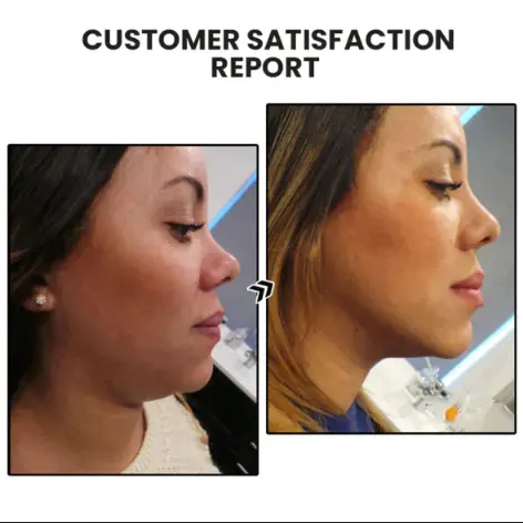 Miniyou Lymphatic Drainage Earrings - Image 11