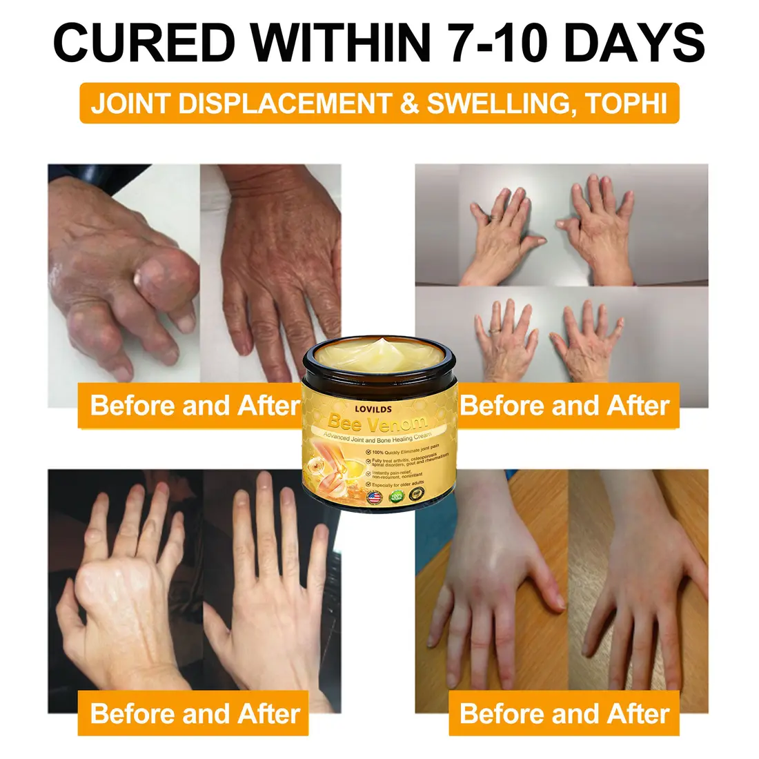 LOVILDS Bee Venom Advanced Joint and Bone Healing Cream - Image 6