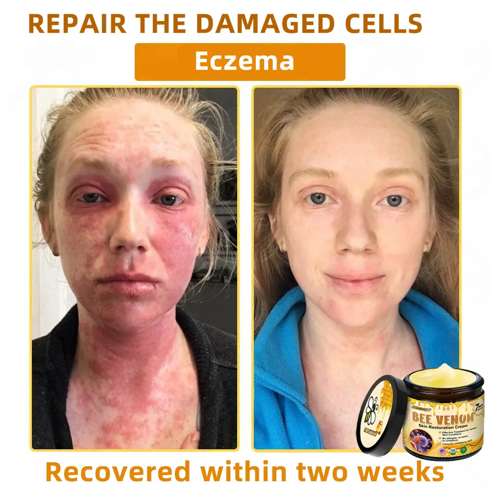 Bee Venom Skin Restoration Cream - Image 9