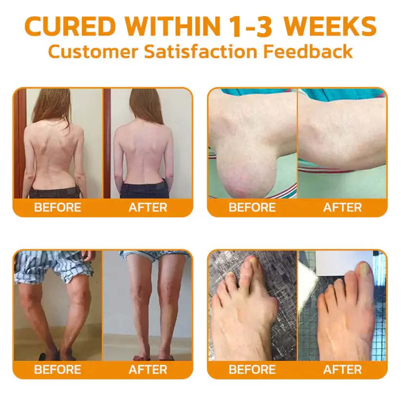 LOVILDS Bee poison Pain ArthritisTherapy Cream - Image 5