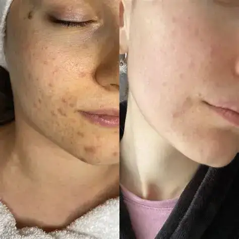 Water Light Anti-Aging Facial Cream - Image 4