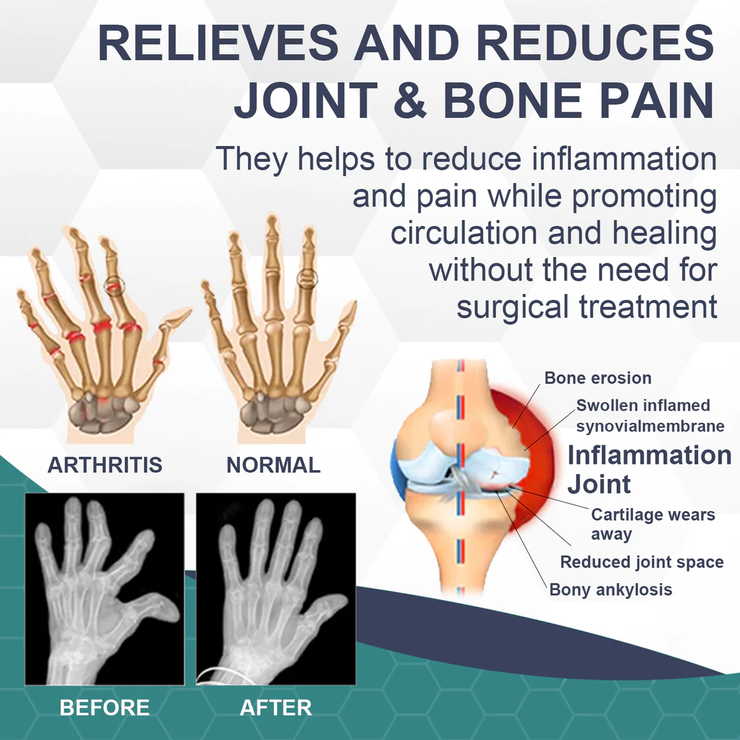 Bee Venom Pain and Bone Healing Cream - Image 2