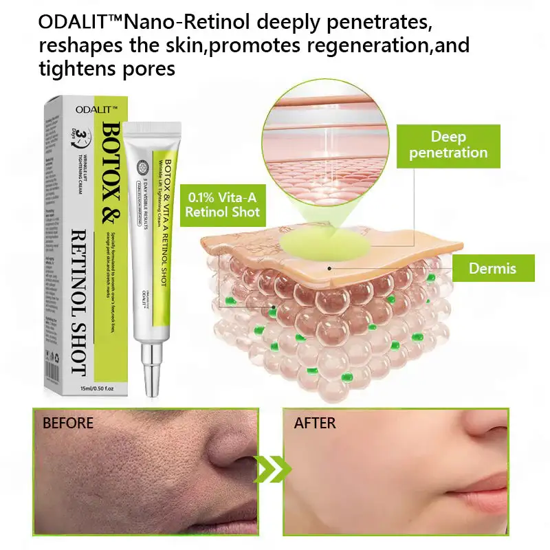 Botox & Retinol Shot - Image 8