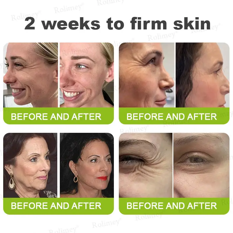 Botox & Retinol Shot - Eraser for Deep Wrinkles - Sagging Jowls & Puffy Eyes - Image 2