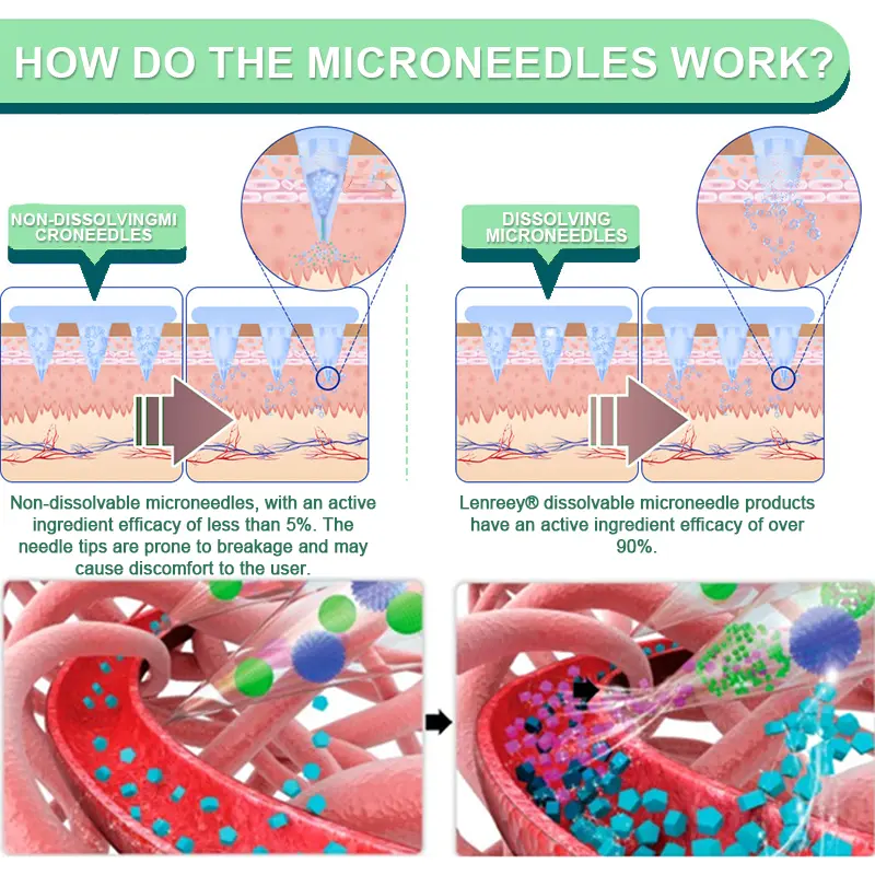 NIDDK-Tirzepatide Slimming & Health NANO MICRONEEDLE PATCH - Image 5