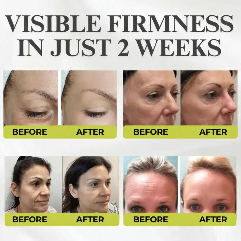 👏🌿Made and shipped from the USA 💫Botox & Vita-A Retinol Shot Wrinkle-Lift Tightening cream - Image 5