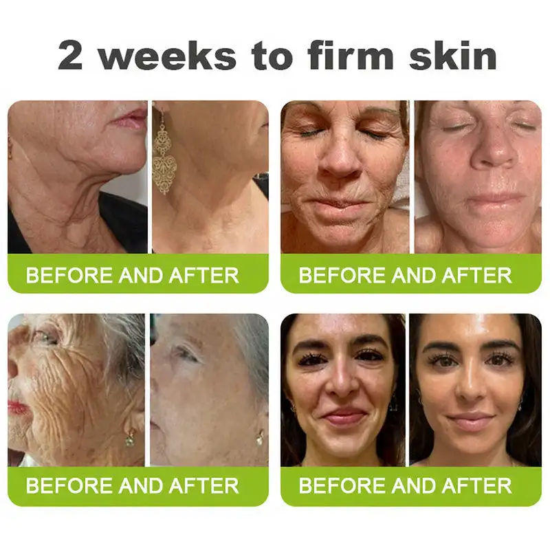 Skin Tightening & Vita-A Retinol Retinol shot Anti-Wrinkle Firming Tightening cream - Image 7