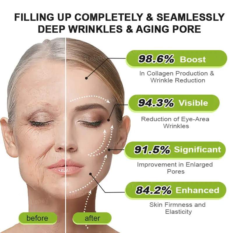 Botox & Vita-A Retinol Shot Wrinkle-Lift Tightening Cream - Image 17