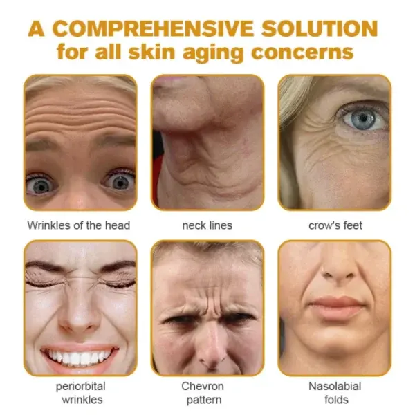 New Year Sale Botox Bee Venom Wrinkle Removal Cream - Image 4