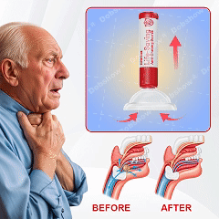Life-Saving Anti-Choking Device - Image 4