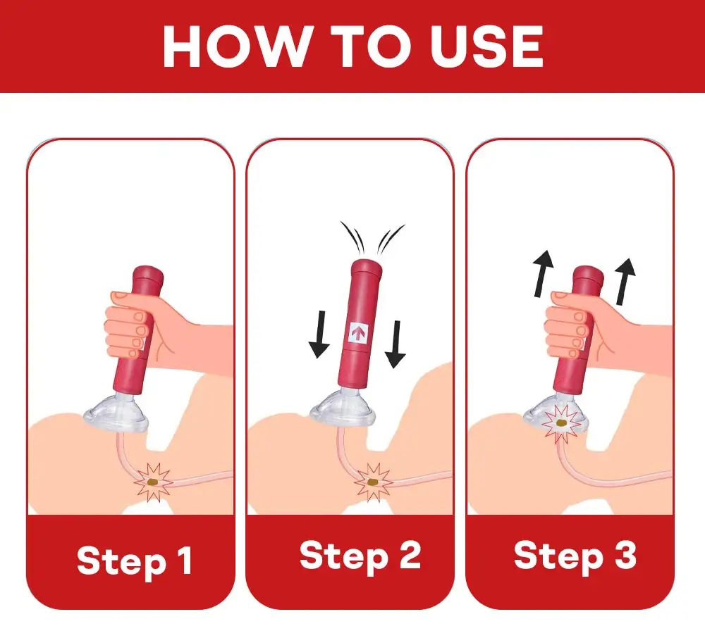 Life-Saving Anti-Choking Device - Image 6