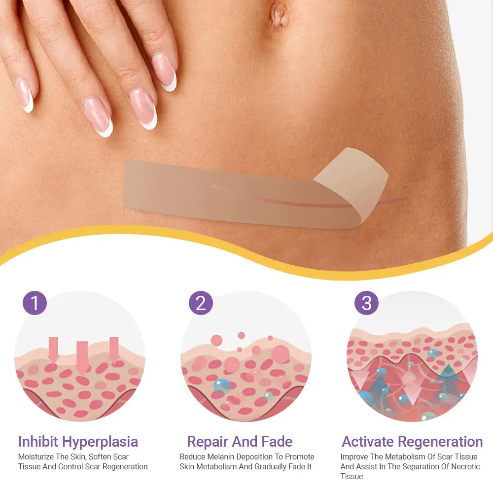 Hyaluronic Acid Nano Microneedle Repair Tape - Image 8