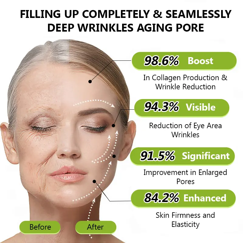 BOTOX & VITA A RETINOL SHOT Anti-Wrinkle Lifting & Firming Cream - Image 12