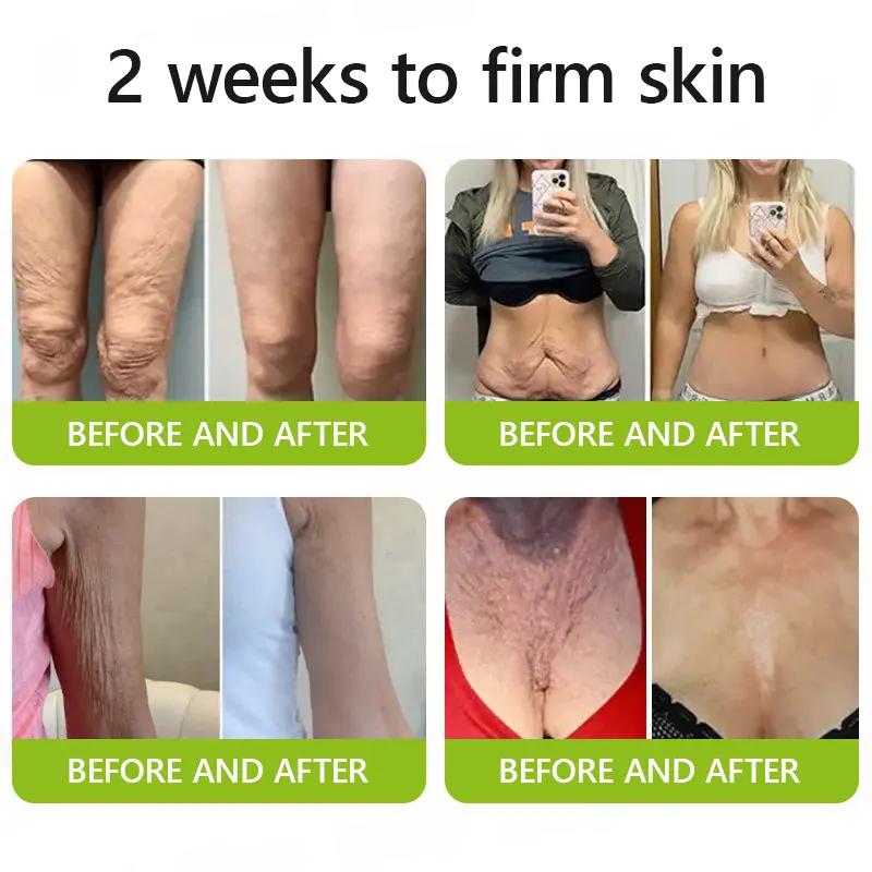 BOTOX & VITA A RETINOL SHOT Anti-Wrinkle Lifting & Firming Cream - Image 5