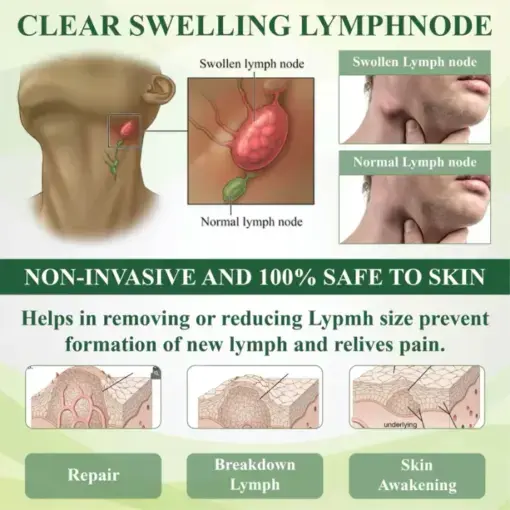 Leg Therapy Edema Cream Trust - Image 2