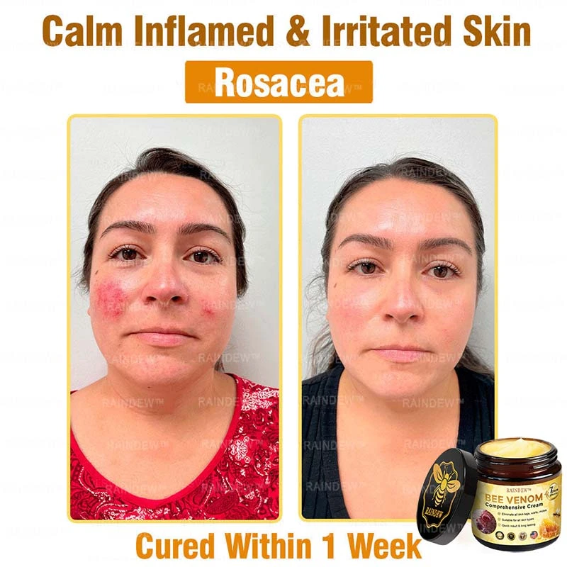 Bee Venom Comprehensive Cream - Image 3
