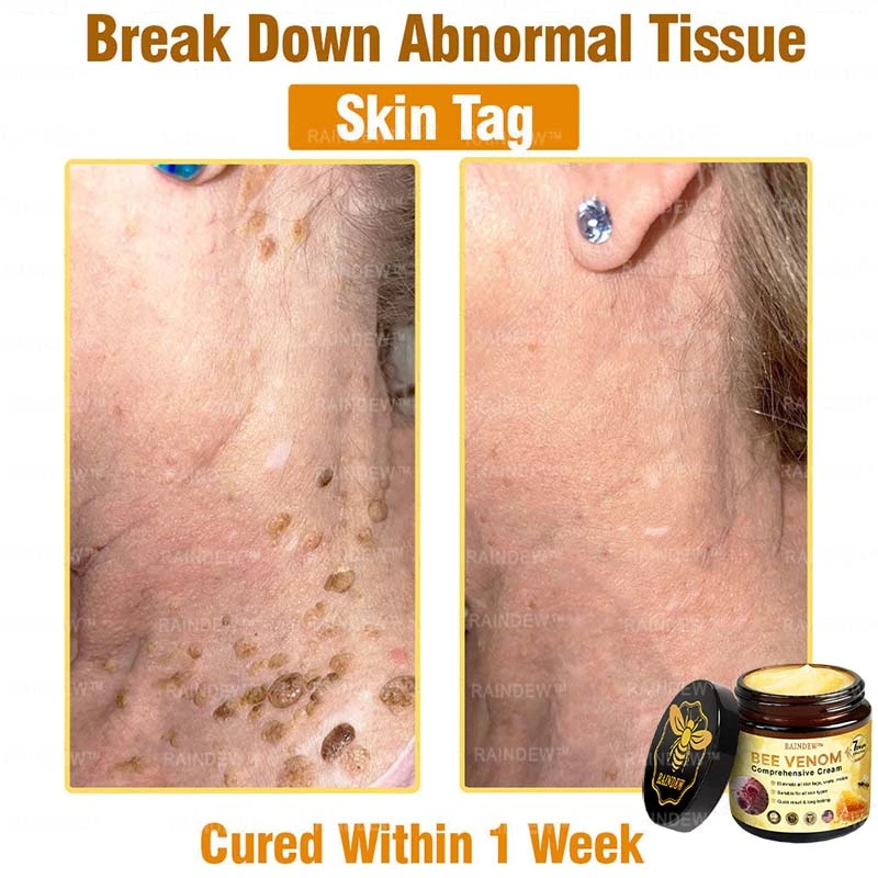 Bee Venom Comprehensive Cream - Image 5