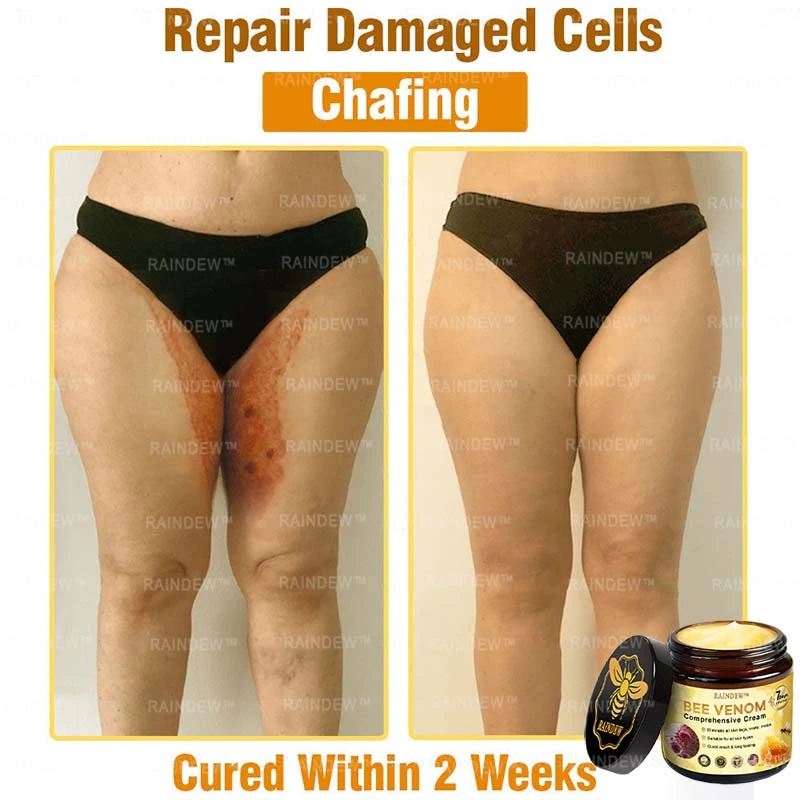 Bee Venom Comprehensive Cream - Image 6