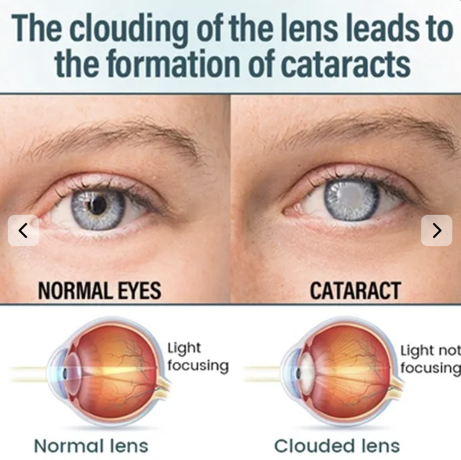 NANO Eye Drops - Image 2