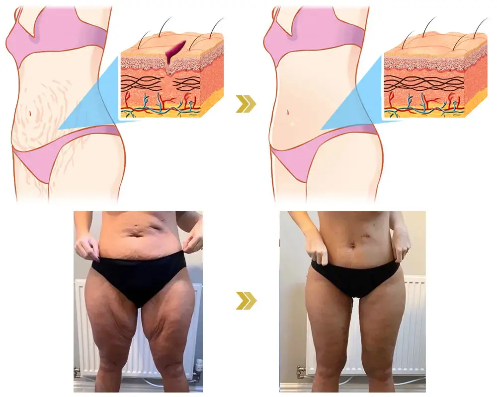 ๐๐๐ฏ๐๐ง๐๐๐ ๐
๐ข๐ซ๐ฆ๐ข๐ง๐ & ๐๐ซ๐ข๐ง๐ค๐ฅ๐-๐๐๐๐ฎ๐๐ข๐ง๐ ๐๐ซ๐๐๐ฆ Pro - Image 6