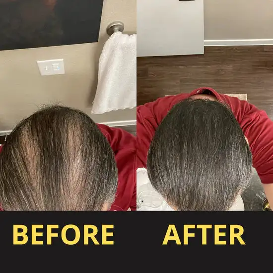 Hair & Scalp Concealer 50ML - Waterproof 3–7 days. - Image 11