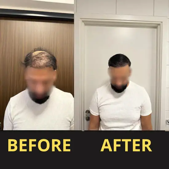 Hair & Scalp Concealer 50ML - Waterproof 3–7 days. - Image 13