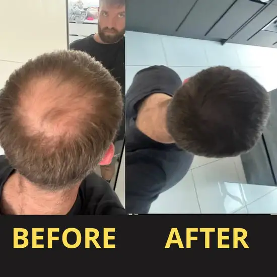 Hair & Scalp Concealer 50ML - Waterproof 3–7 days. - Image 14