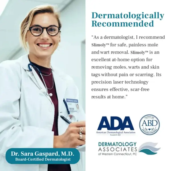 LumeSkin Mole and Wart Removal Laser Pen - Image 2